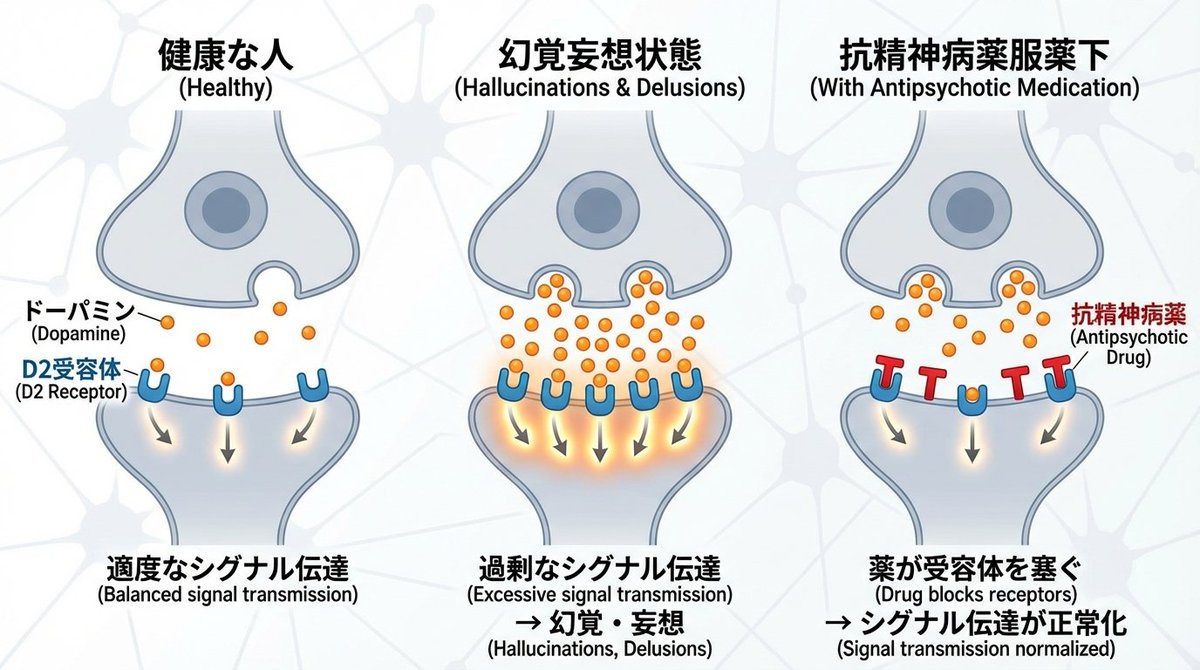 Schizophrenia and Dopamine Receptor Diagram (Nano Banana Pro)
